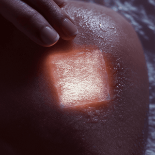 Do Stem Cell Patches Really Work?
